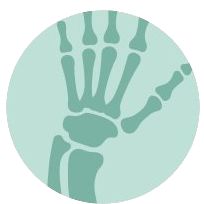 Orthopädie Hand